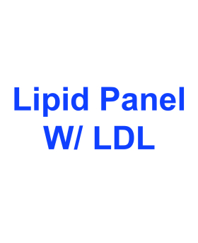 Lipid Panel With LDL:HDL Ratio